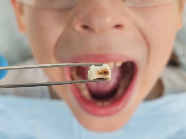 Best Emergency Gum Treatment in Kaukauna, WI